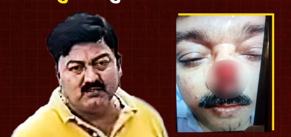 कानपुर के बिठूर जिले के रतन प्लेनेट हाईराइज सोसाइटी पार्किंग विवाद में नरभक्षियों जैसी हरकत,डिप्टी डायरेक्टर ने चबा डाली सचिव की नाक !